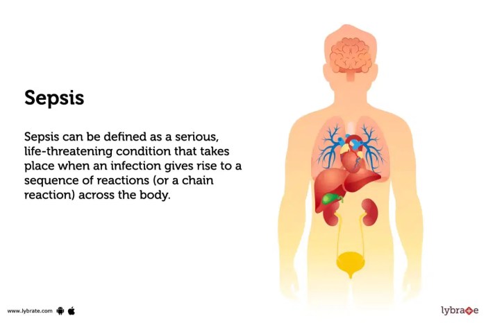 Sepsis treatment