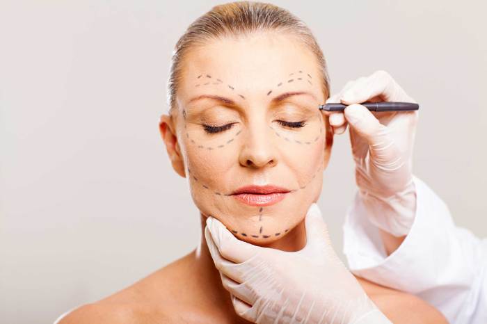 Plastic surgery benefits