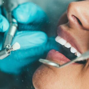Gum quanto gengivite dura periodontal pinhole technique grafting differences teeth cleaning deland
